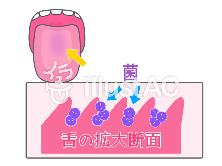 舌の汚れイラスト No 無料イラストなら イラストac