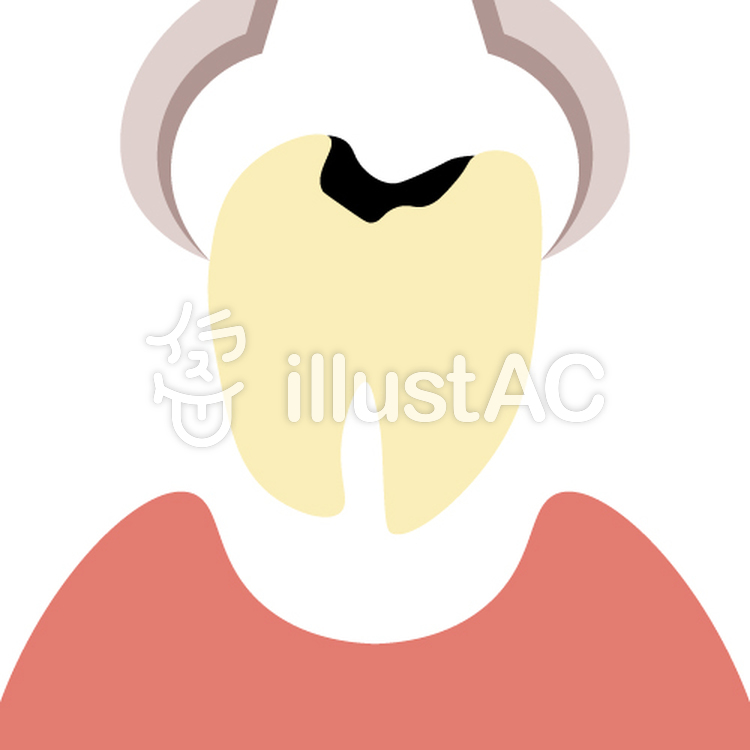 歯科 抜歯 イラスト No 無料イラストなら イラストac